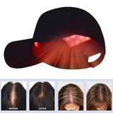 Red Light Therapy Hat 650nm&850nm Treatment Cap Hat Hair Loss Growth Regrowth