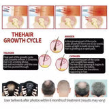 Red Light Therapy Hat 650nm&850nm Treatment Cap Hat Hair Loss Growth Regrowth